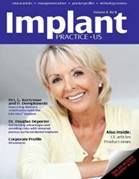 Dental Implants Procedure