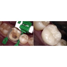 QuickConnect Regular + Mixed Intro Kit