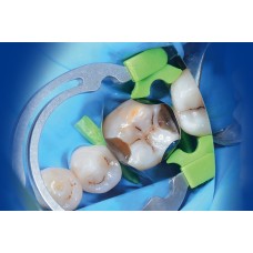 Polydentia myRing Forte, myTines GO, Refill 6 pairs