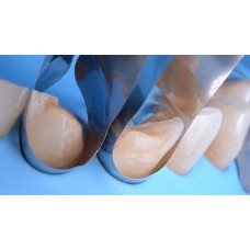 Polydentia Unica Anterior Matrix Intro Kit