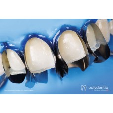 Polydentia Unica Anterior Matrix Intro Kit