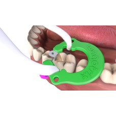 Autoclaveable Universal Matrix Ring - Qty 35