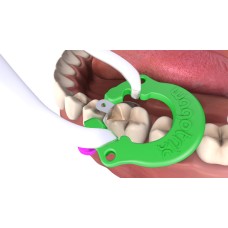 Autoclaveable Universal Matrix Ring - Qty 35