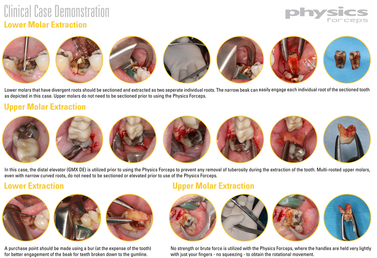 Clinical Case Demonstration