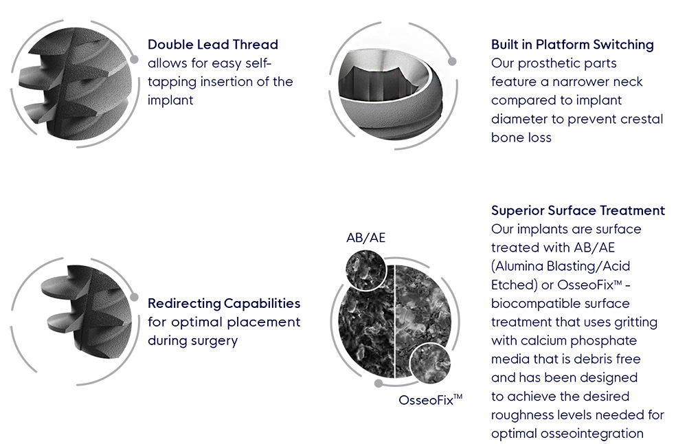 Dental Implants Diagram