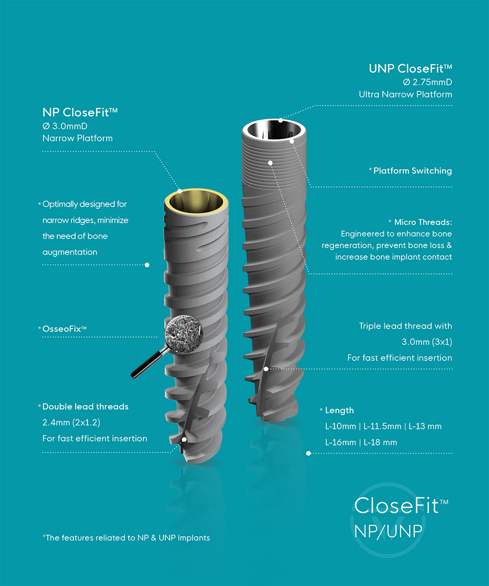 features describe to NP & UNP Implants Image
