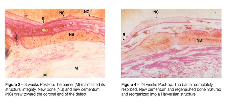 Cytoflex® Resorb® membranes