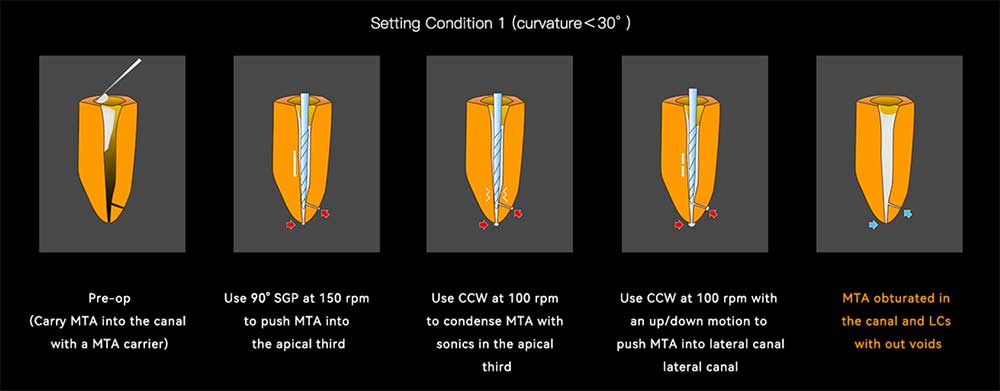 setting condition 01