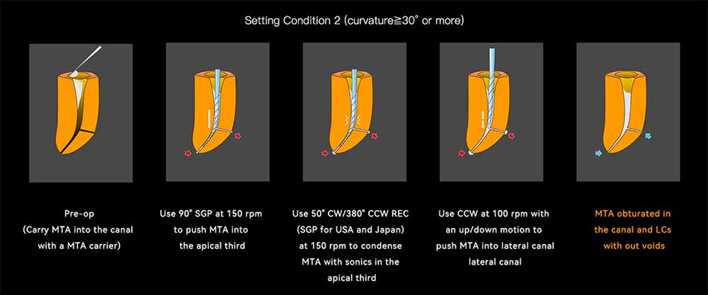 setting condition 02