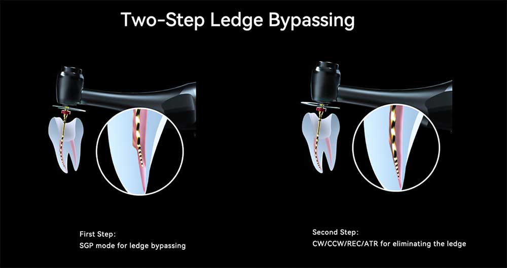 Upgraded and Improved automatic T-Mode for by passing a ledge